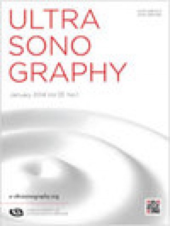 超聲檢查
